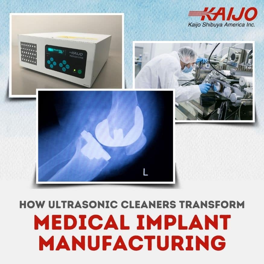 How Ultrasonic Cleaners Transform Medical Implant Manufacturing